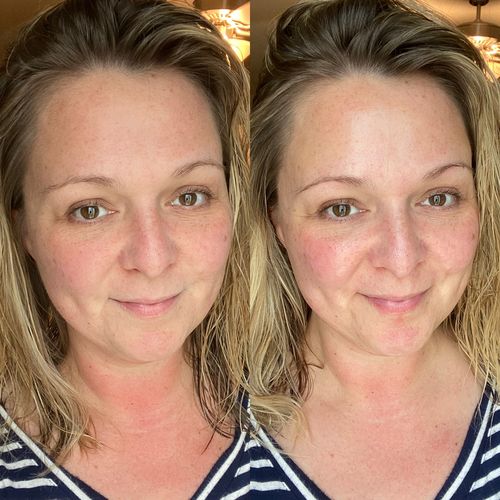 FaceLift Magic Belt