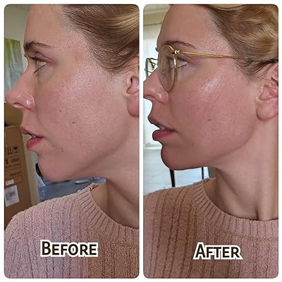FaceLift Magic Belt