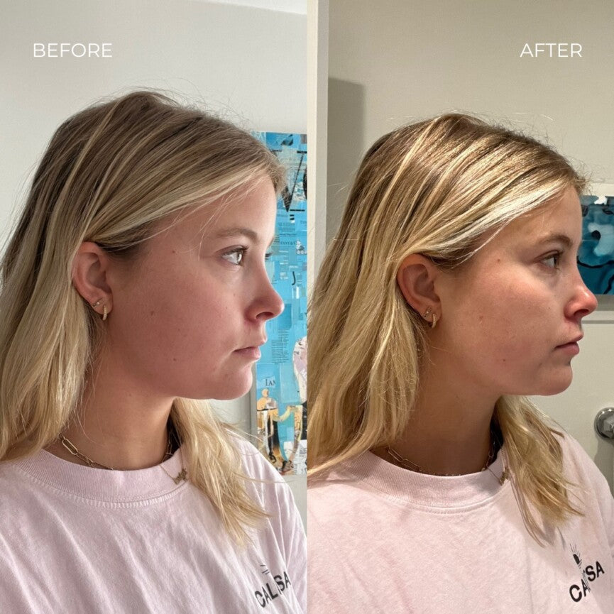 FaceLift Magic Belt