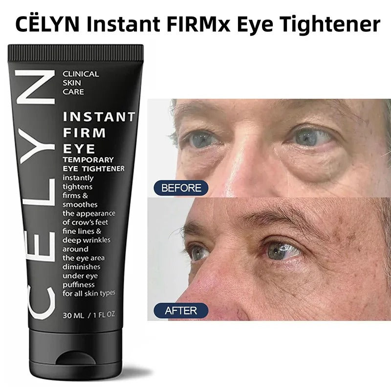 Celyn™Eye Care Cream (70% OFF)