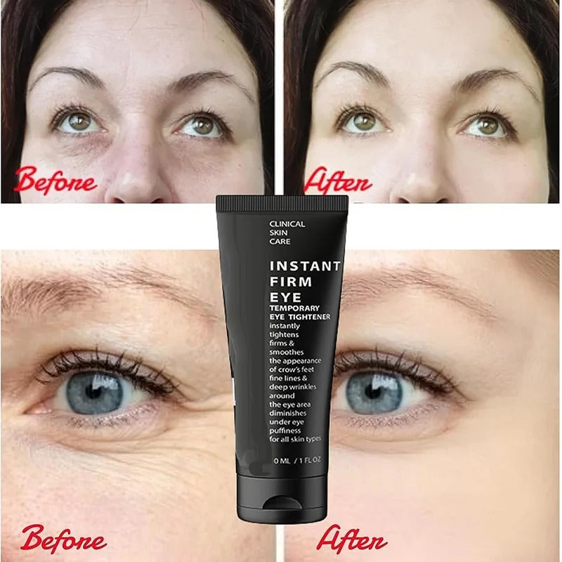 Celyn™Eye Care Cream (70% OFF)