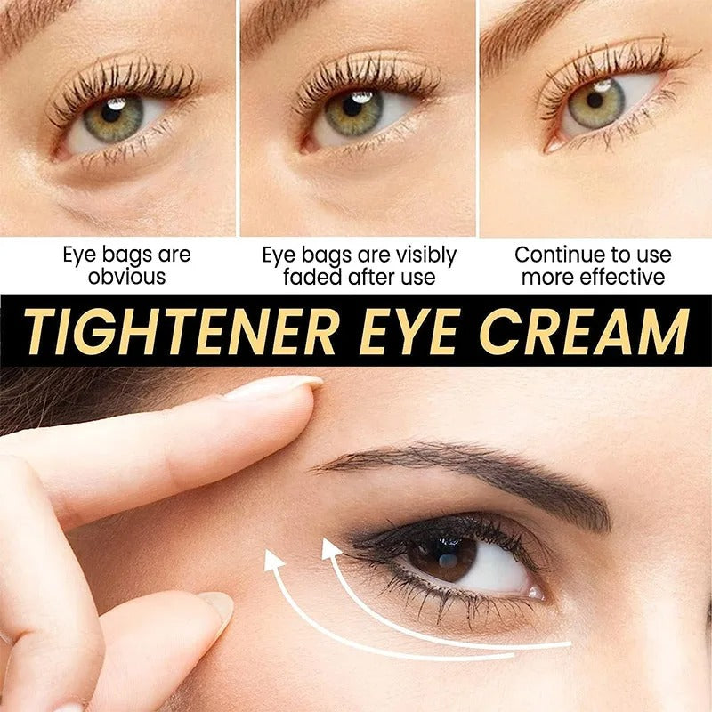 Celyn™Eye Care Cream (70% OFF)