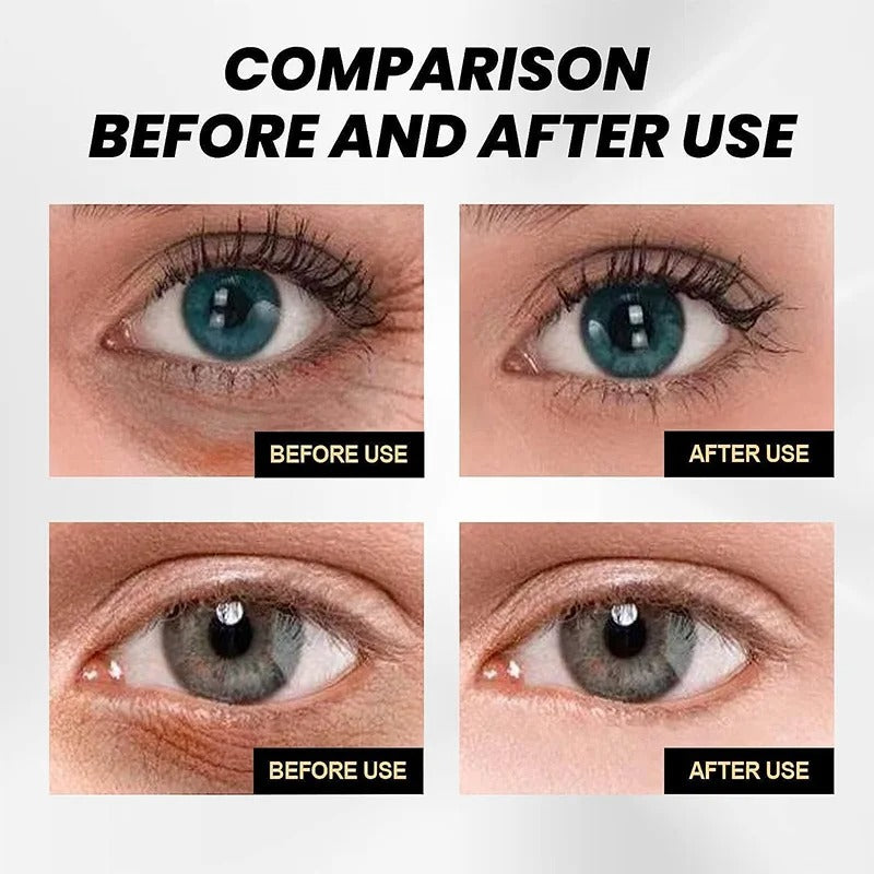 Celyn™Eye Care Cream (70% OFF)